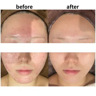 DahliaBeauty ダリアビューティー所属・DahliaBeau tyフェイシャル中村のエステ・リラクイメージ