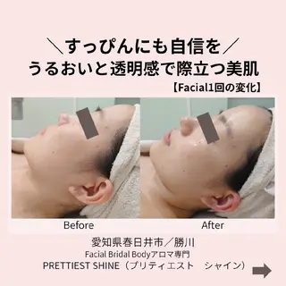 PRETTIEST SHINE所属・山田 浩子のエステ・リラクイメージ