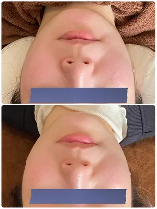 FLEURフェイシャ ル🫧ハーブ🌿小顔のエステ・リラクイメージ