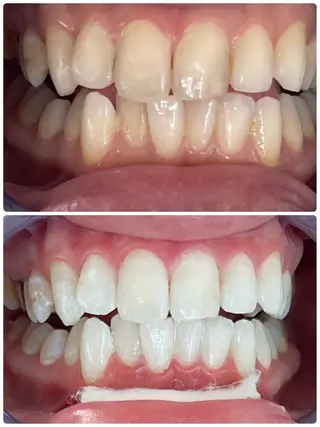 セルフホワイトニング エクシア徳島店マユのその他イメージ