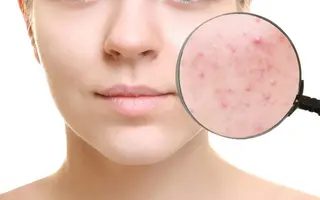 rasera所属・rasera コラボ予約のネイルデザイン