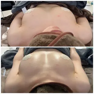 湘南エステサロン moaのエステ・リラクイメージ