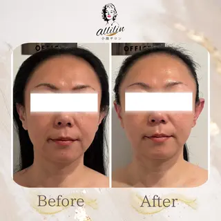 小顔サロンallilin所属・💎allilin 五所川原💎本間のエステ・リラクイメージ