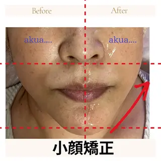 akua... 【肌質管理専門】のその他イメージ