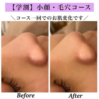 Bellesthe （ベルエステ）のエステ・リラクイメージ