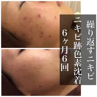 ミディアム カラー パーマ ヘアアレンジ メンズ キッズ ネイル マツエク・マツパ ニキビ・肌質改善専門 ♡人生が変わるサロンのエステ・リラクイメージ