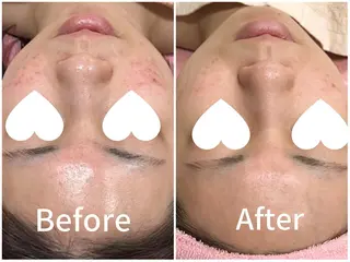 産後/ツヤ肌/子連れ /保育士在籍サロンのエステ・リラクイメージ