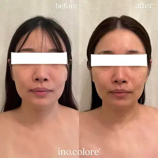 エステサロンino.colore'所属・小顔サロン ino.coloreのエステ・リラクイメージ