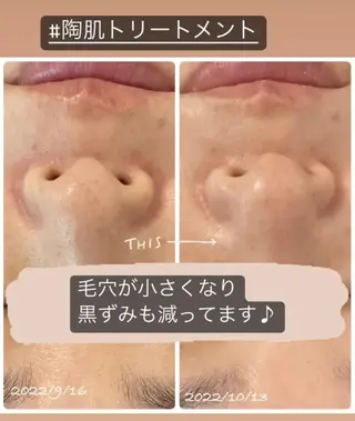 luana beauty所属・kana ハーブピーリング🌿のエステ・リラクイメージ