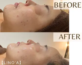 Salon💫 Lino'a柏店のエステ・リラクイメージ