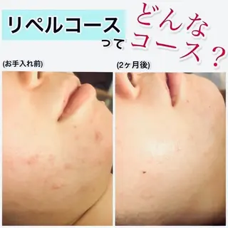 ペリドットラボ naoのエステ・リラクイメージ