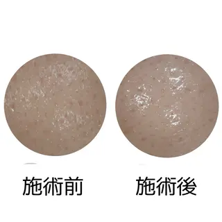 メナードフェイシャルサロン丸の内ヒルズ所属・メナード丸の内ヒルズ 柳田りさのエステ・リラクイメージ