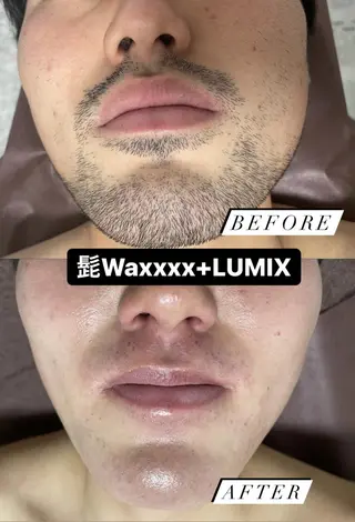 メンズ キッズ Epina 千葉店 【エピナ】のエステ・リラクイメージ