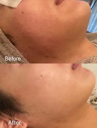 Remina clinical salon所属・ハイフ美肌専門 Remina.c.sのエステ・リラクイメージ