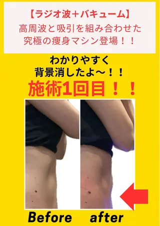 毛穴フェイシャル エステ専門店BBのエステ・リラクイメージ