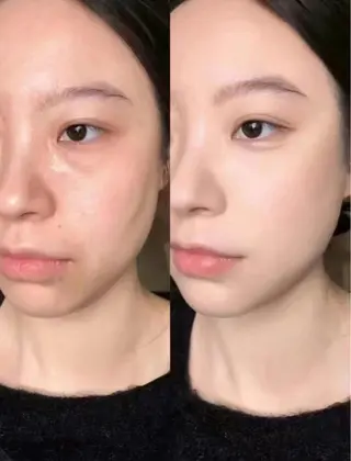 マツエク・マツパ aliaハイフ&水光ジェットサロン所属・aliaハーブ水光店 エステティシャン募集のエステ・リラクイメージ