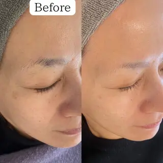 シミケア専門店 &More所属・シミケア専門店 &Moreのエステ・リラクイメージ