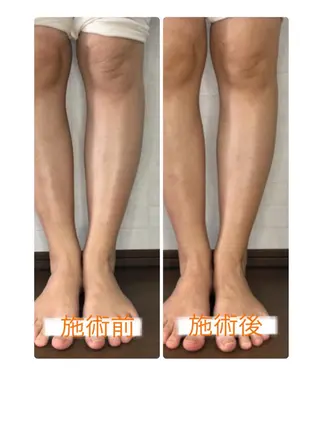 小顔・毛穴・たるみ ネイル　似内真樹のエステ・リラクイメージ