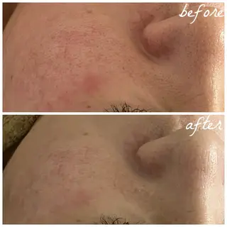 メンズ メナード岐阜茜部 杉浦のエステ・リラクイメージ