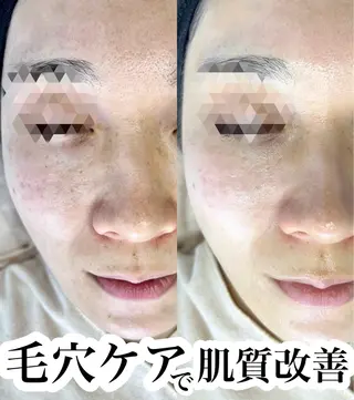 アイラッシュ＆フェイシャルサロン　ベアトリーチェ所属・医療提携美容サロン Beatriceのエステ・リラクイメージ