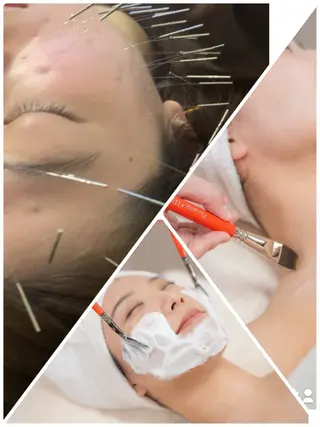 表参道鍼灸院K 美容鍼🔮ララピールのエステ・リラクイメージ