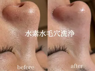 肌管理サロン neoriiのその他イメージ