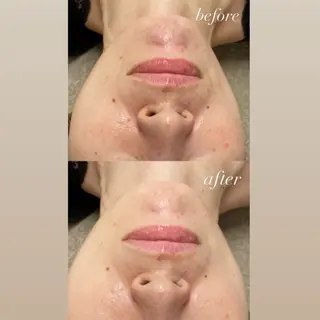 smile nail スマイルネイルのその他イメージ