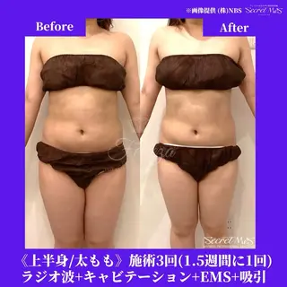 メンズ 有人型セルフサロン 脱毛/痩身/美顔のその他イメージ