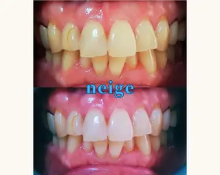 ホワイトニングサロン ネージュ(女性専用)のその他イメージ