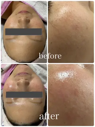 Lulu estheticsalon所属・Lulu 　田村 梨乃のエステ・リラクイメージ