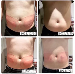 秒速小顔所属・秒速小顔 岩邊のその他イメージ