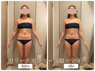 ブライダルサロン ｜Lino【堀江】のエステ・リラクイメージ