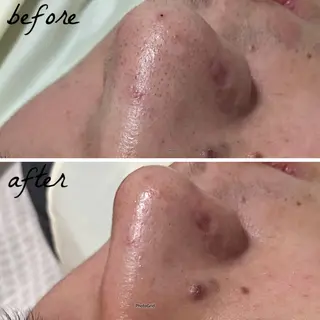 メンズ メナード岐阜市茜部 杉浦のエステ・リラクイメージ