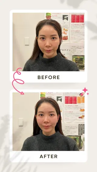 健康×美容鍼鍼灸院 あさば整体院三ノ輪店のエステ・リラクイメージ