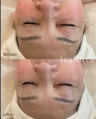 egg tea forêtのエステ・リラクイメージ