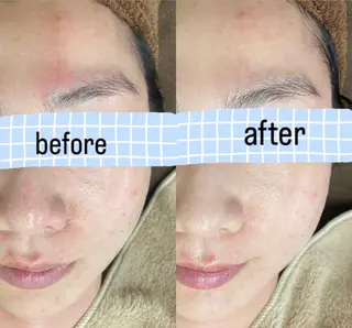 RE:moom リムーム/脱毛エステのエステ・リラクイメージ