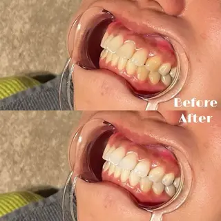 # fu♡のエステ・リラクイメージ