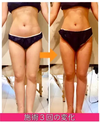 ロング カラー パーマ ヘアアレンジ メンズ キッズ ネイル マツエク・マツパ ‍痩身＆ボディ 結果出し🌟丹野のエステ・リラクイメージ