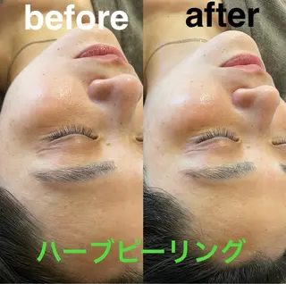 美容鍼灸サロン mahoroba院長のエステ・リラクイメージ