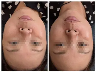 美肌と小顔のサロン RUVIAのエステ・リラクイメージ