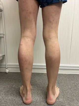 メンズ 脱毛サロン BRIDGE橋本のエステ・リラクイメージ