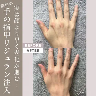 脱毛&増毛&肌管理サロンJemo所属・脱毛増毛肌管理サロン Jemoのエステ・リラクイメージ