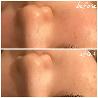 メンズ メナード岐阜市茜部 杉浦のエステ・リラクイメージ