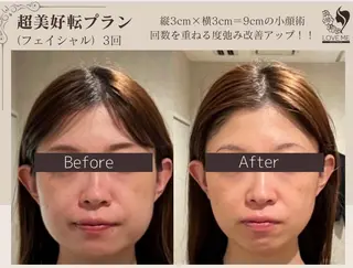 総合美容サロン LOVEME渋谷本店のエステ・リラクイメージ