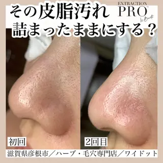 Ydot. 池内 友架のエステ・リラクイメージ