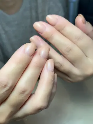 ネイル 𝐴𝑁𝑈𝐸 トラブル爪育成専門のネイルデザイン