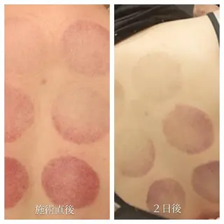 🅖🅤🅩🅔🅛 salonのエステ・リラクイメージ