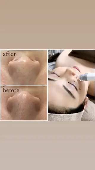 crescent所属・【韓国肌管理・脱毛】 クレセントのその他イメージ