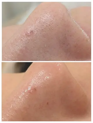 babyaiai所属・babyaiai 　momo🍑のエステ・リラクイメージ