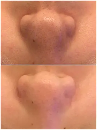 毛穴専門店Bébéもりの里店所属・毛穴専門店Bébé もりの里店のエステ・リラクイメージ